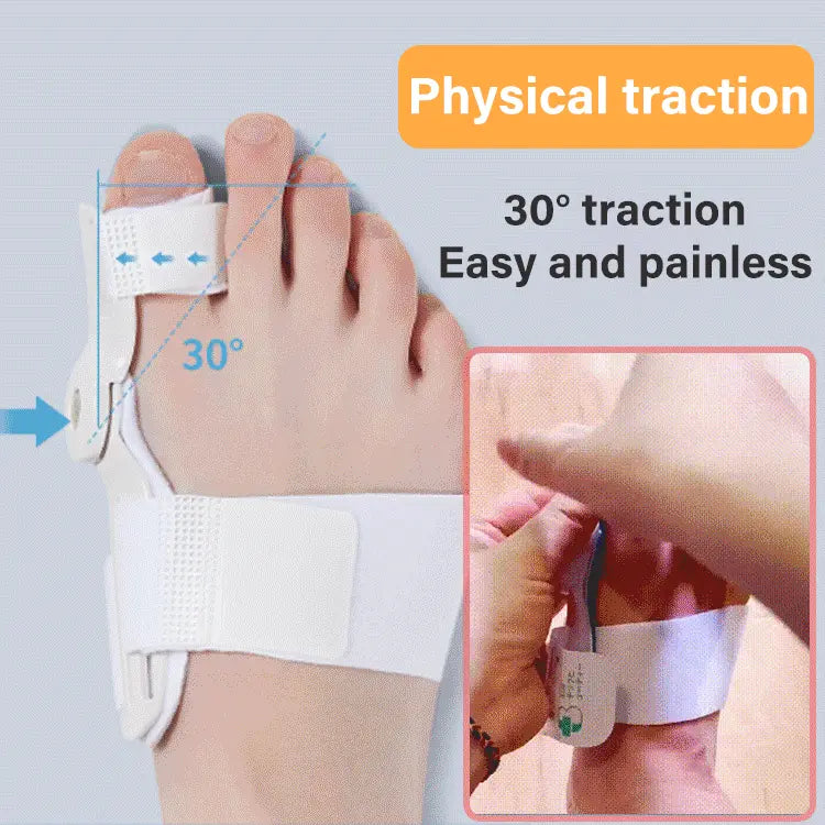 (1 készlet 2 darab) Toe Corrector Tökéletes a lábujjak, Hallux Valgus, Kalapács és Lábujj igazításának korrekciójához! (Megfelelő súly 40-80 kg)