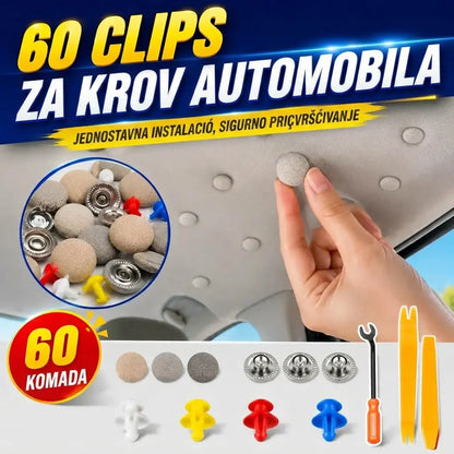 🔥【30 komada】🚗Kopče za skidanje platna s krova automobila, uključujući alate za ugradnju, olakšavaju uklanjanje i sastavljanje.