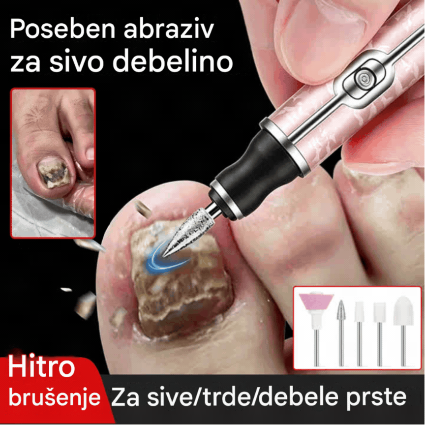 💅👍 Električna pilica za nohte za zdravljenje onihomikoze