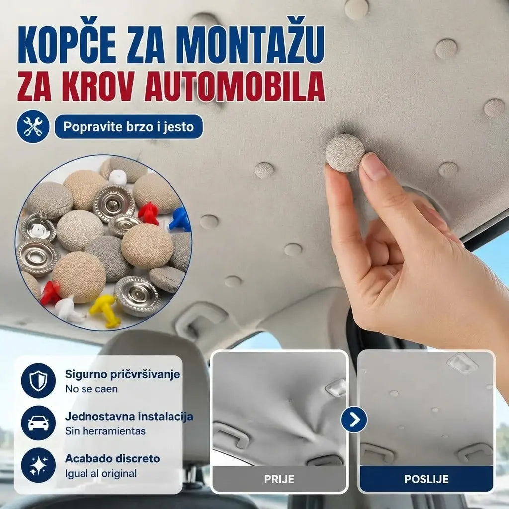 🔥【30 komada】🚗Kopče za skidanje platna s krova automobila, uključujući alate za ugradnju, olakšavaju uklanjanje i sastavljanje.