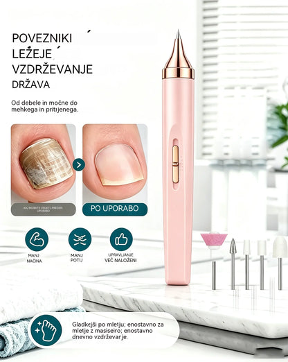 💅👍 Električna pilica za nohte za zdravljenje onihomikoze