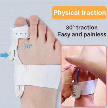 (1 készlet 2 darab) Toe Corrector Tökéletes a lábujjak, Hallux Valgus, Kalapács és Lábujj igazításának korrekciójához! (Megfelelő súly 40-80 kg)