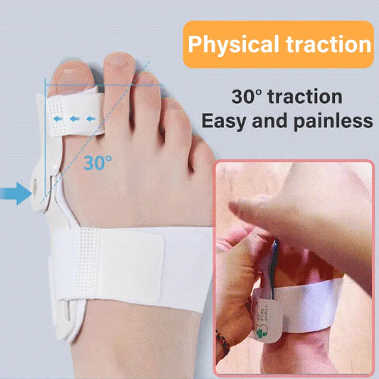 (1 készlet 2 darab) Toe Corrector Tökéletes a lábujjak, Hallux Valgus, Kalapács és Lábujj igazításának korrekciójához! (Megfelelő súly 40-80 kg)