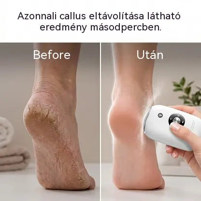 💅 Elektromos lábreszelő, körömágybőr eltávolító, pedikűr eszköz