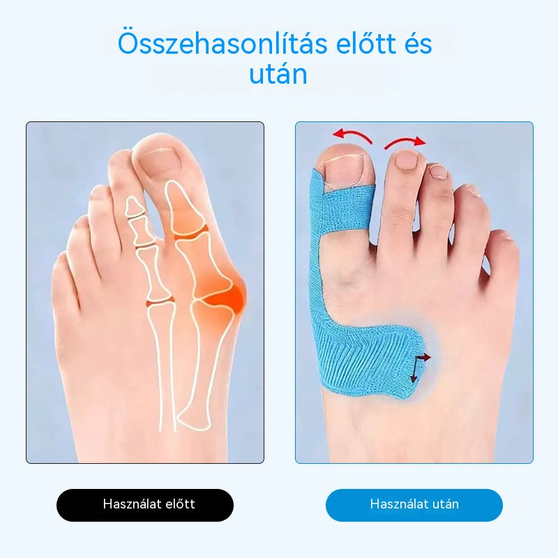 👍Hallux valgus korrekciós tapasz – fájdalomcsillapítás + lábforma korrekció egyben!