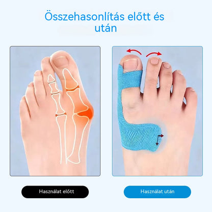 👍Hallux valgus korrekciós tapasz – fájdalomcsillapítás + lábforma korrekció egyben!