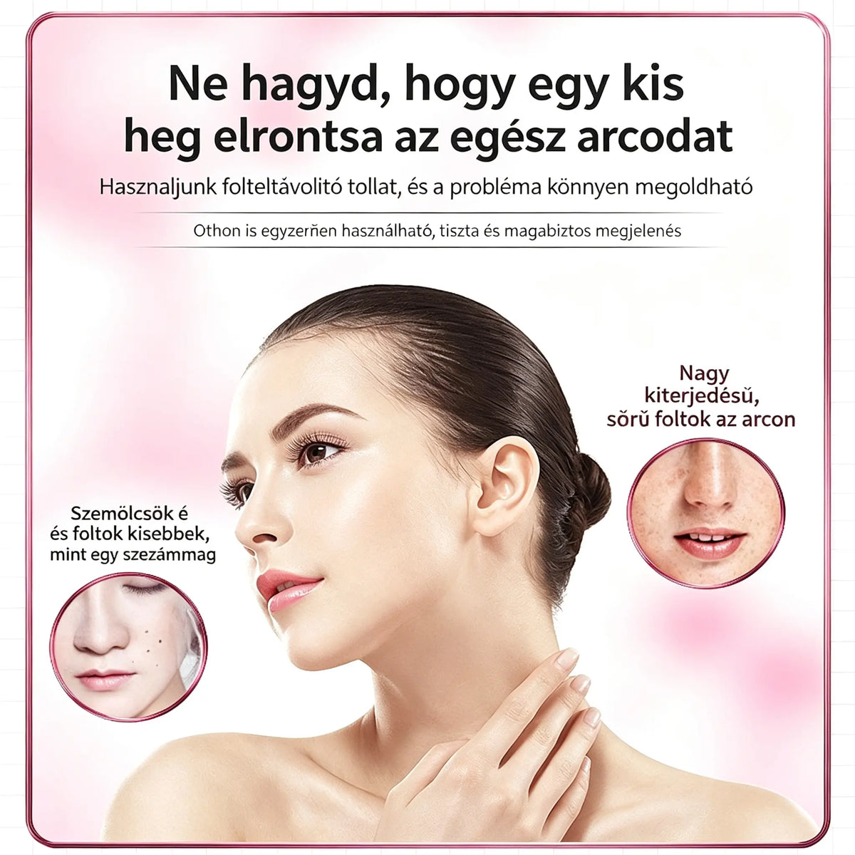 👩🏻‍🦰💥2026 Új, otthoni használatra szánt, fájdalommentes anyajegy- és folteltávolító toll, fehérítő és folteltávolító eszköz