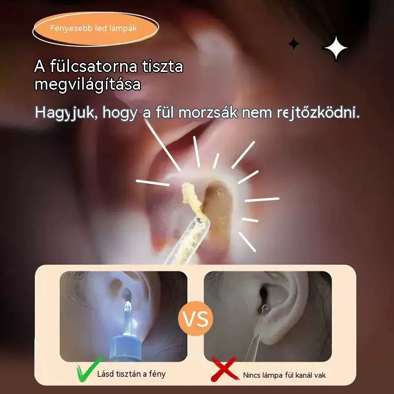 👂💡Elektromos vizuális fültisztító pálcika, egyszerre tisztít és szív, csendes és kényelmes.