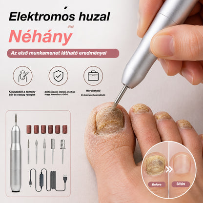 💅👍 Elektromos körömreszelő az onychomycosis kezelésére