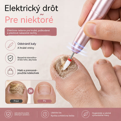 💅👍 Elektrický pilník na nechty používaný na liečbu onychomykózy (plesne nechtov)