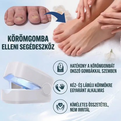 【🔥Top Eladó】2026 Új körömgomba kezelő eszköz, ultraibolya körömfény terápiás lámpa